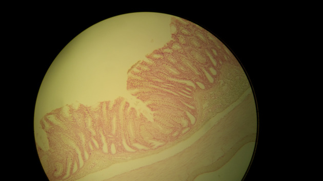 Colon Slides - Colon 003 100X